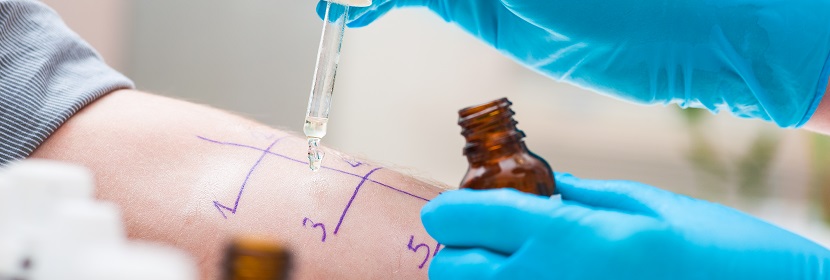 皮膚變態(tài)反應(yīng)試驗(yàn)