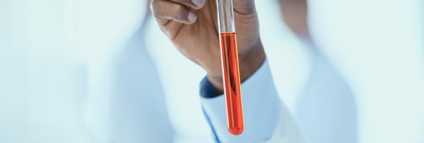 硫化促進劑ZEHBP檢測